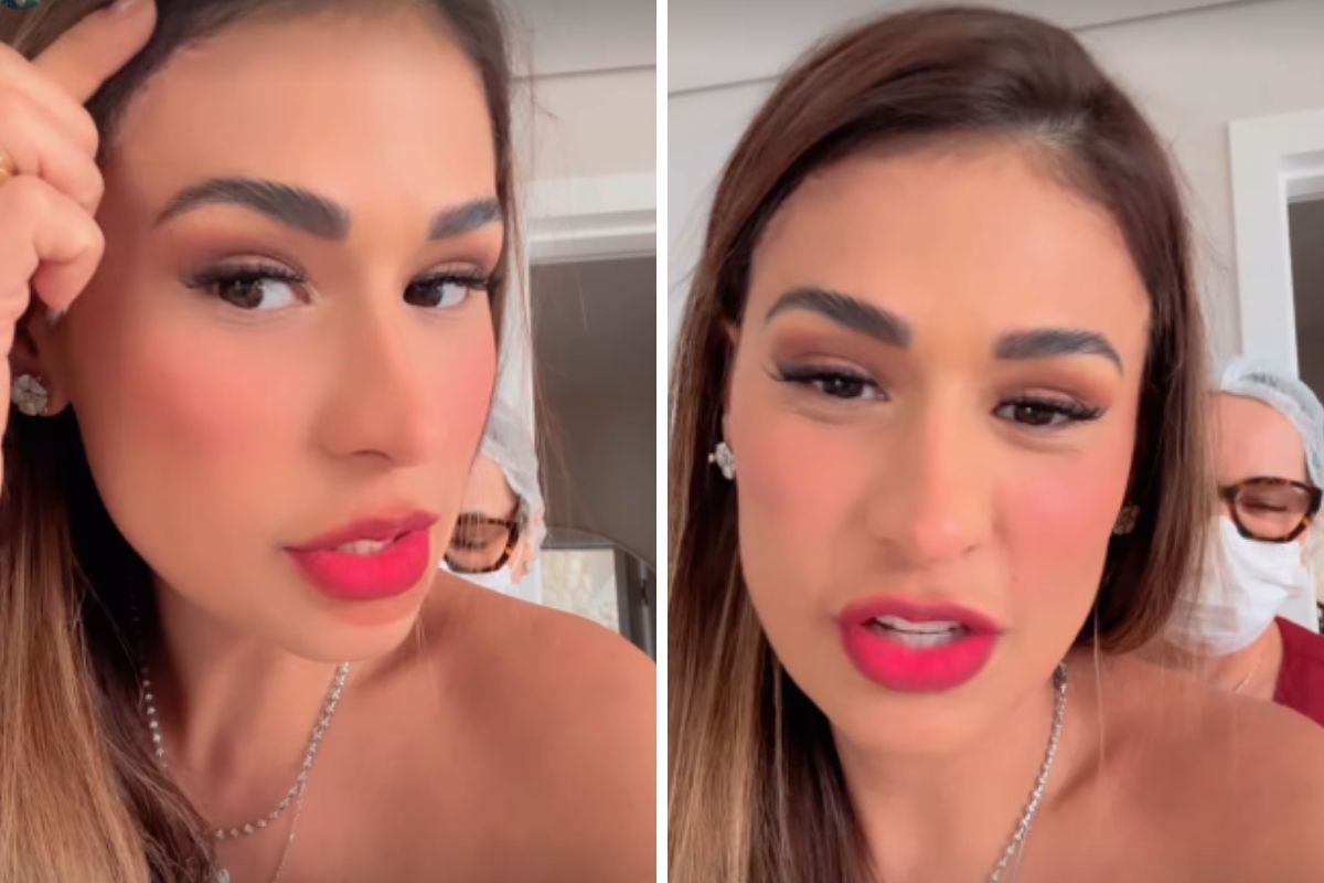 Simone Mendes faz cirurgia no rosto e mostra cicatriz