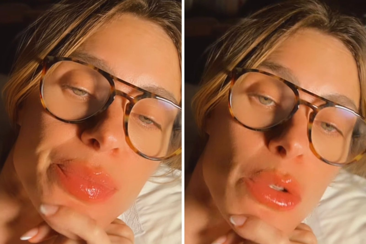 Carolina Dieckmann exibe boca inchada. Preenchimento?