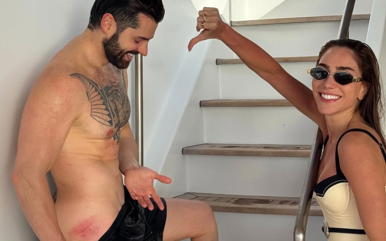 Alok exibe machucados após viagem com a família na Europa
