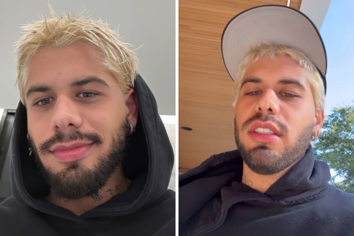 Brincadeira após show termina com lesão para Zé Felipe