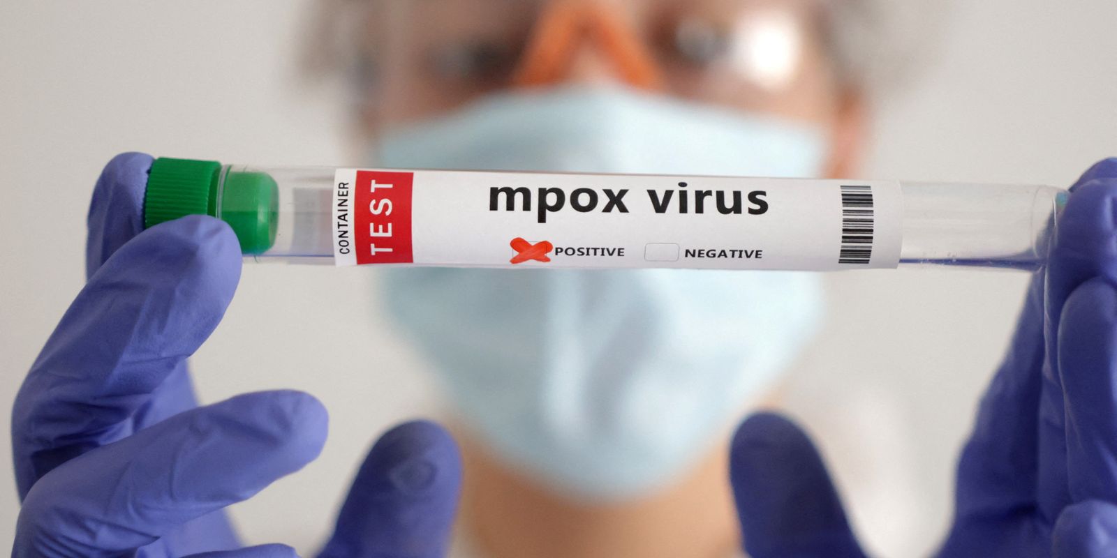 Mpox: África tem quase 50 mil casos confirmados