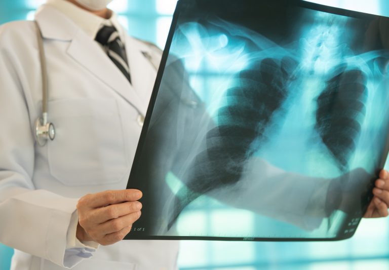 Comissões debatem impacto da doença pulmonar obstrutiva crônica na população idosa – Notícias