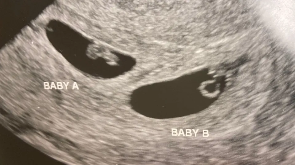 EUA: Bilionário chinês usa barriga de aluguel para ter mais de 100 filhos
