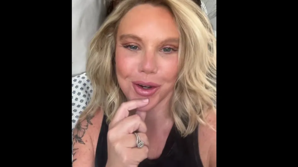 Mulher mostra como ficou rosto após lifting; “Prefiro continuar feia”