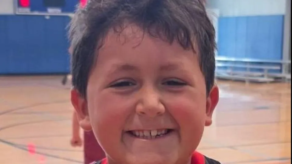 Menino faz desafio do TikTok e acaba com rosto desfigurado