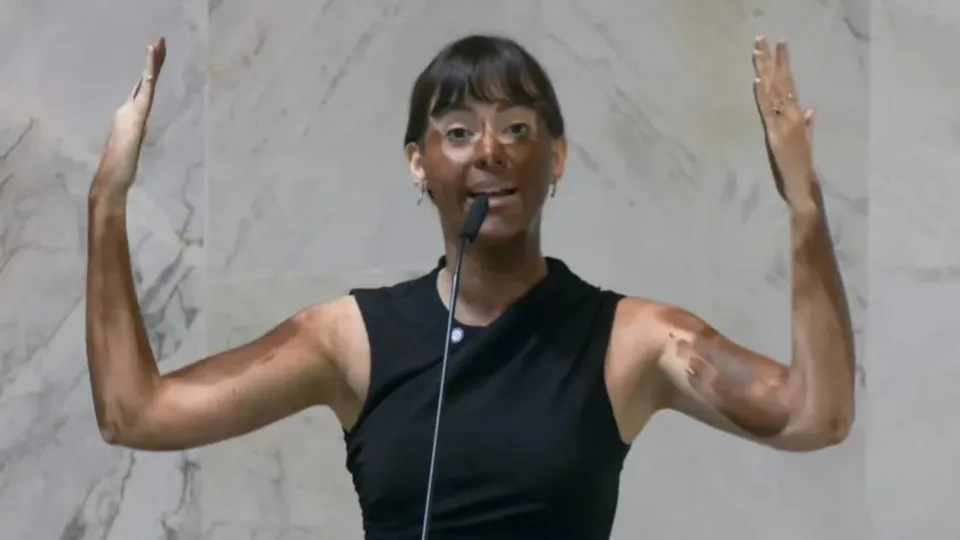 Deputada Fabiana Bolsonaro faz ‘blackface’ em protesto transfóbico