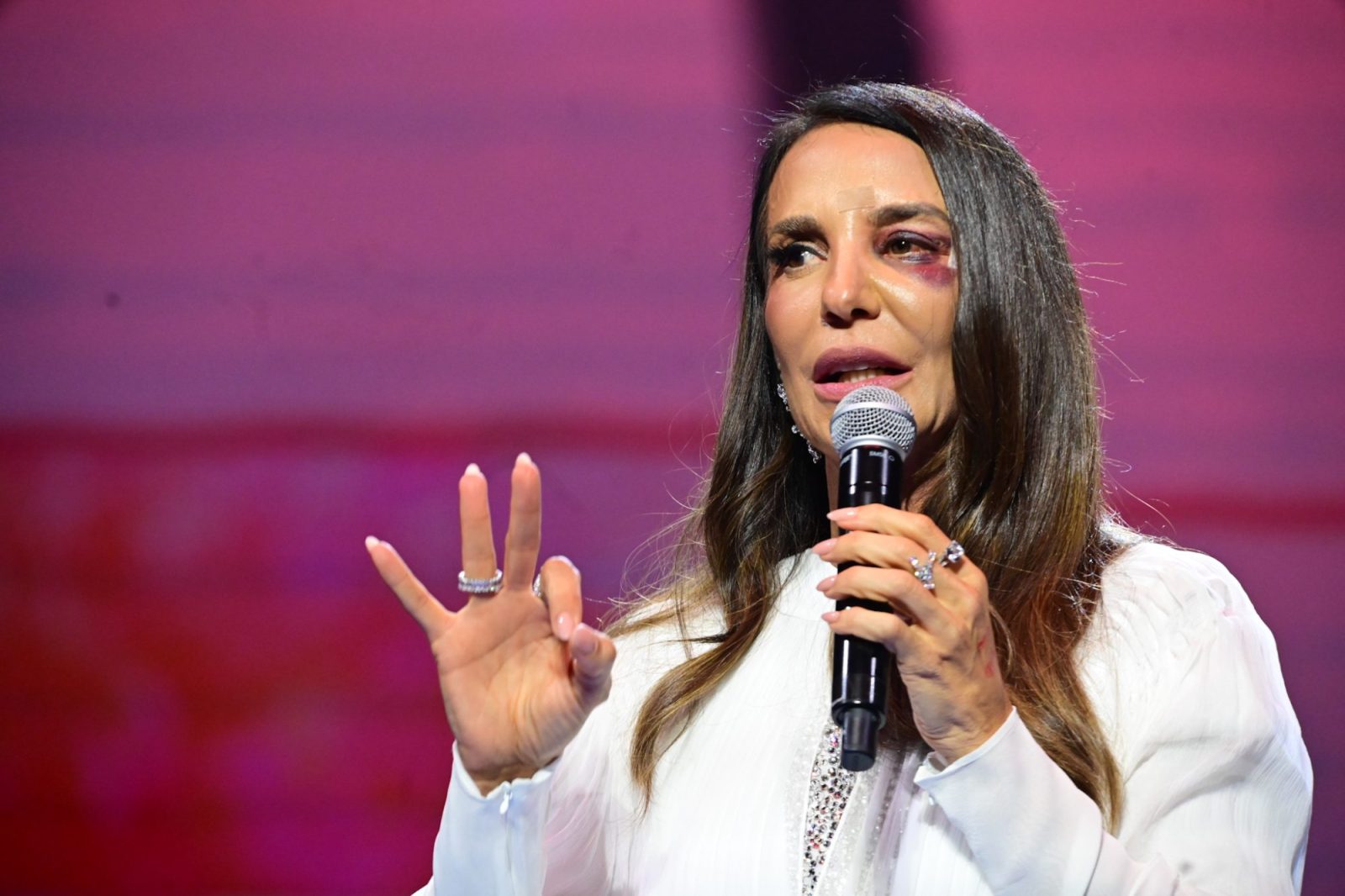 Ivete Sangalo revela que fará cirurgia neste domingo (1º)