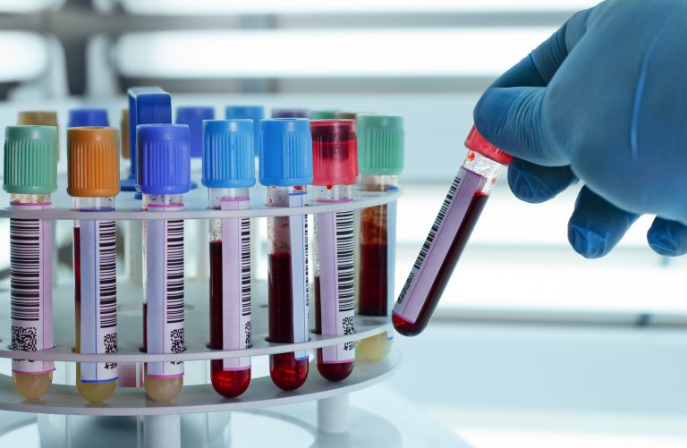 Lei determina que empresas divulguem campanhas de conscientização sobre vacinas, HPV e câncer – Notícias